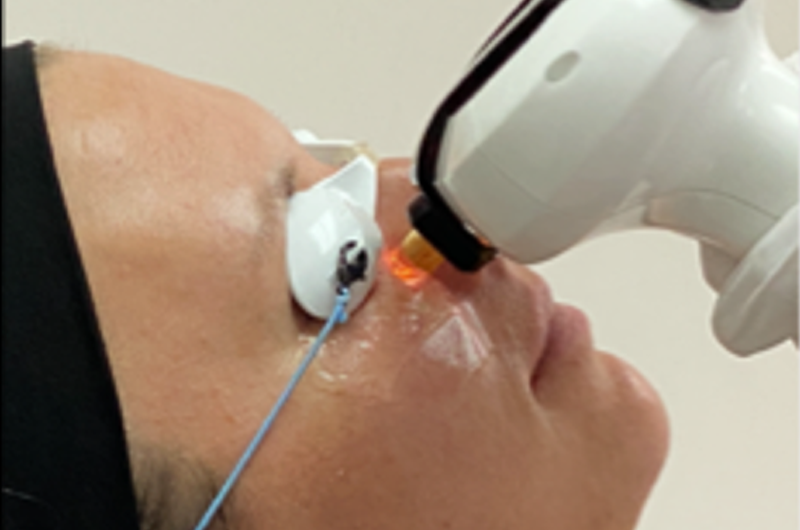 Dry Eye & Facial Rejuvination